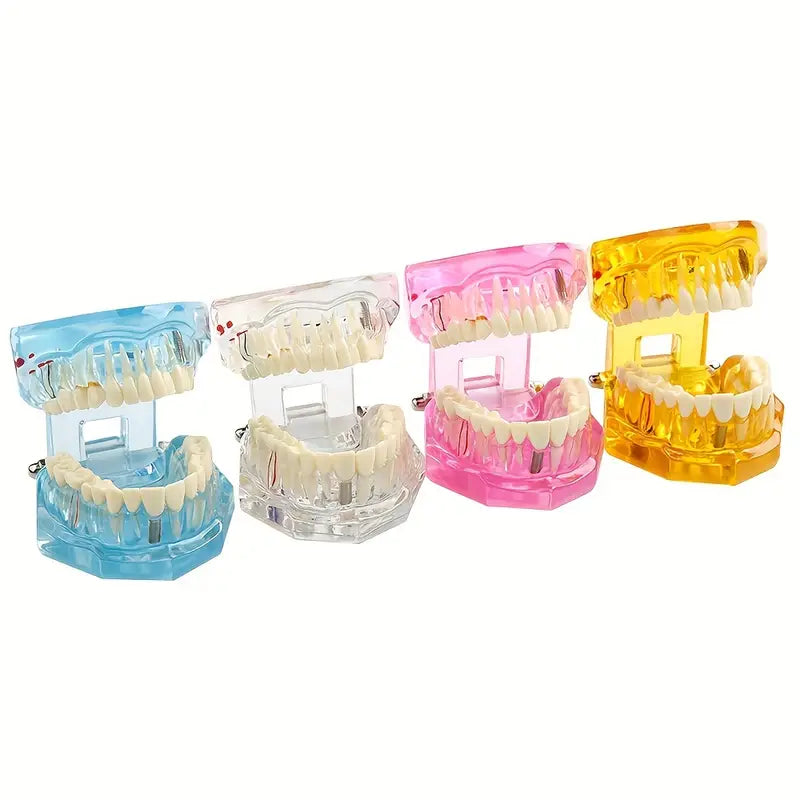 Modèle de Mâchoire Articulée avec Dents – Maquette Anatomique Colorée pour Formation et Démonstration Dentaire