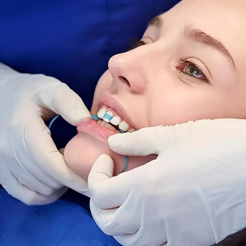 Élastiques Orthodontiques Dentaires – Accessoires Médicaux pour Correction et Alignement des Dents