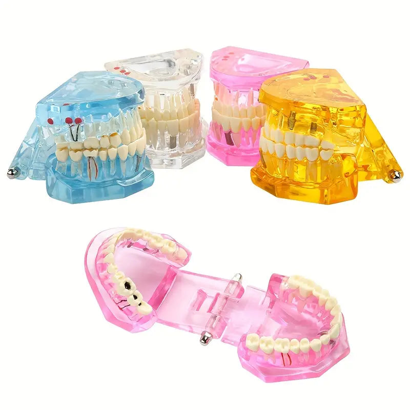 Modèle de Mâchoire Articulée avec Dents – Maquette Anatomique Colorée pour Formation et Démonstration Dentaire