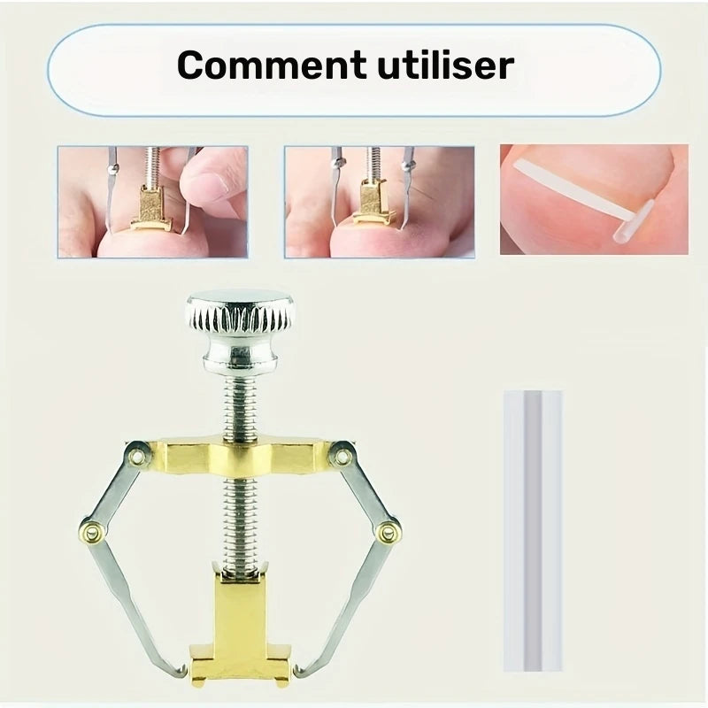 Extracteur d’Ongles Incarnés Professionnel – Outil Correcteur de Pédicure en Acier Inoxydable