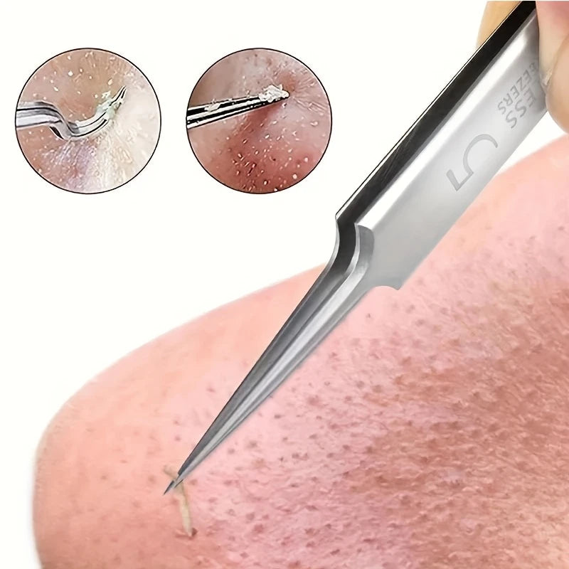 Pince à Épiler de Précision Ultra-Fine en Acier Inox – Idéale pour Poils Incarnés, Points Noirs et Soins du Visage