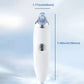 Aspirateur de Points Noirs Rechargeable – Nettoyeur de Pores Professionnel à Succion Forte